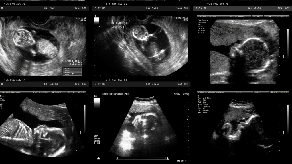 teste-gravidez-positivo-londrina